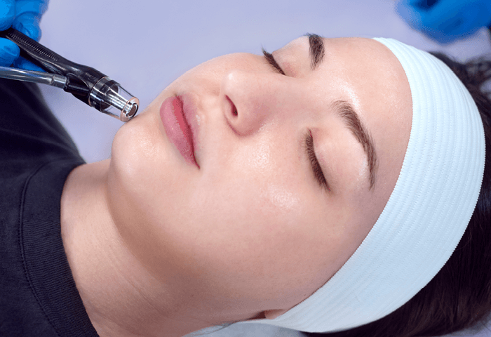 Woman with her eyes closed during a microderm infusion session at Massage Envy clinic. 