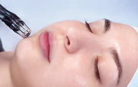 Woman relaxing during mircroderm treatment at Massage Envy